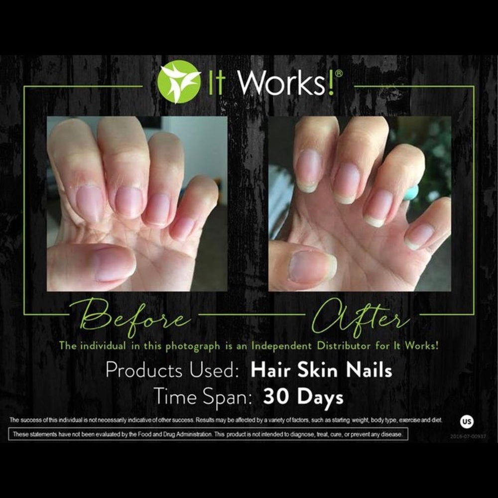 Hair skin nails